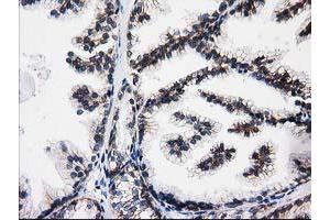 Immunohistochemical staining of paraffin-embedded Human prostate tissue using anti-ACY3 mouse monoclonal antibody. (Aminoacylase 3 Antikörper)