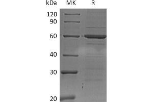 SDS-PAGE (SDS) image for Interferon Regulatory Factor 5 (IRF5) protein (His tag) (ABIN7455628)