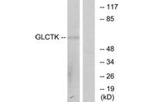 Western blot analysis of extracts from NIH-3T3 cells, using GLCTK Antibody. (GLYCTK Antikörper  (AA 101-150))