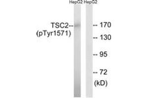 Western Blotting (WB) image for anti-Tuberous Sclerosis 2 (TSC2) (AA 1537-1586), (pTyr1571) antibody (ABIN1532185) (Tuberin Antikörper  (pTyr1571))