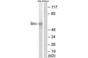 Western blot analysis of extracts from HeLa cells, using Src (Ab-529) Antibody. (Src Antikörper  (AA 487-536))