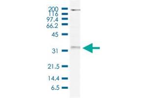 Western Blot (Cell lysate) analysis of 20 ug nuclear extracts of HeLa cells. (WDR61 Antikörper)