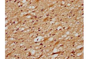 IHC image of ABIN7149649 diluted at 1:700 and staining in paraffin-embedded human brain tissue performed on a Leica BondTM system. (DLL3 Antikörper  (AA 27-492))