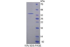 SDS-PAGE analysis of Mouse ACADM Protein. (Acyl-CoA Dehydrogenase, C-4 To C-12 Straight Chain (ACADM) Protein)