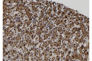 ABIN6272510 at 1/100 staining Human liver tissue by IHC-P. (MAGAC Antikörper)