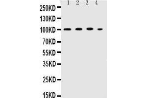 Observed bind size: 100KD (ICAM1 Antikörper  (AA 214-532))