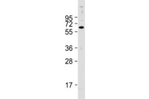 Western blot testing of human HepG2 cell lysate with PTH1R antibody at 1:2000. (PTH1R Antikörper  (AA 52-86))