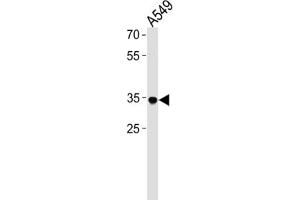 Western Blotting (WB) image for anti-Rhox Homeobox Family, Member 2B (RHOXF2B) antibody (ABIN3000753) (RHOXF2B Antikörper)