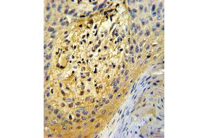 Formalin-fixed and paraffin-embedded human skin tissue reacted with SPARC Antibody , which was peroxidase-conjugated to the secondary antibody, followed by DAB staining. (SPARC Antikörper  (C-Term))