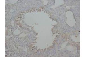 Immunohistochemical analysis of Paraffin-Embedded Rat Tissue Sections (Lung) using RAGE antibody. (RAGE Antikörper  (Middle Region))