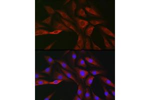 Immunofluorescence analysis of NIH/3T3 cells using SOCS3 Rabbit pAb (ABIN3021099, ABIN3021100, ABIN3021101 and ABIN6213950) at dilution of 1:50 (40x lens). (SOCS3 Antikörper  (C-Term))