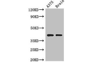 Western Blot Positive WB detected in: A375 whole cell lysate, Mouse brain tissue All lanes: SEPT12 antibody at 3. (Septin 12 Antikörper  (AA 1-358))