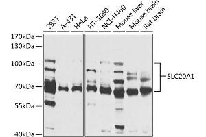 Western blot analysis of extracts of various cell lines, using SLC20 antibody (ABIN1682754, ABIN3018562, ABIN3018563 and ABIN6220499) at 1:1000 dilution. (SLC20A1 Antikörper  (AA 257-356))