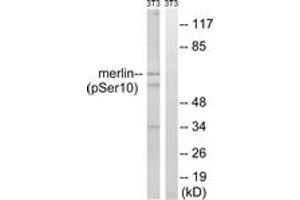 Western blot analysis of extracts from NIH-3T3 cells treated with IFN 2500U/ml 30', using Merlin (Phospho-Ser10) Antibody. (Merlin Antikörper  (pSer10))
