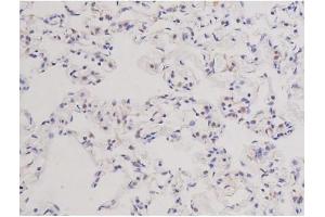 ABIN6266578 at 1/200 staining Rat lung tissue sections by IHC-P. (Ki-67 Antikörper  (Internal Region))