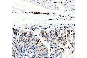 IHC analysis of CD31 using anti-CD31 antibody (ABIN5692990).