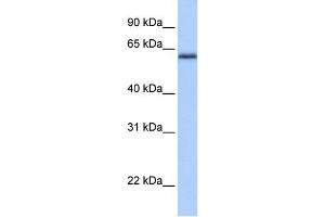 WB Suggested Anti-ZNF417 Antibody Titration:  0. (ZNF417 Antikörper  (N-Term))