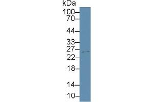 Western Blot; Sample: Mouse Cerebrum lysate; ;Primary Ab: 3µg/ml Rabbit Anti-Mouse TIMP4 Antibody;Second Ab: 0. (TIMP4 Antikörper  (AA 42-224))