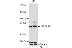 Western blot analysis of extracts of C6 cells, using Phospho-RP-T21 Rabbit mAb (ABIN7269916) at 1:1000 dilution. (RPA2 Antikörper  (pThr21))