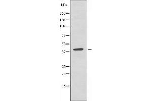 ZFP36L2 Antikörper  (Internal Region)