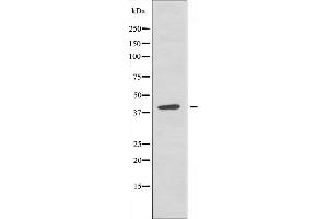 Western blot analysis of extracts from A549 cells, using TISD antibody. (ZFP36L2 Antikörper  (Internal Region))