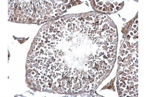IHC-P Image DMC1 antibody [N1C1] detects DMC1 protein at nucleolus on mouse testis by immunohistochemical analysis.