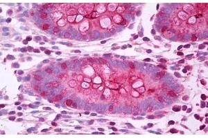 Anti-CEA antibody IHC staining of human colon. (CEACAM5 Antikörper)
