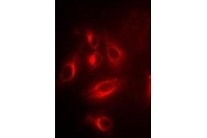 Immunofluorescent analysis of TPMT staining in U2OS cells. (TPMT Antikörper)