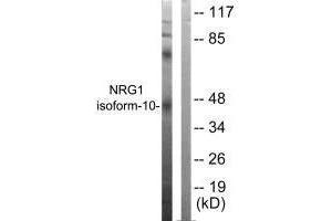 Western blot analysis of extracts from SKOV3 cells, using NRG1 isoform-10 antibody. (Neuregulin 1 Antikörper  (Isoform 10))