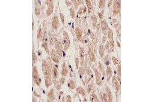 (ABIN6242180 and ABIN6577907) staining ADORA2A in Human heart tissue sections by Immunohistochemistry (IHC-P - paraformaldehyde-fixed, paraffin-embedded sections). (Adenosine A2a Receptor Antikörper  (C-Term))