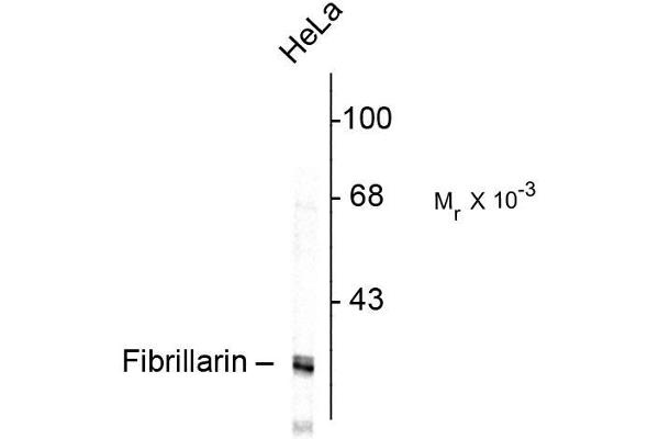 Fibrillarin antibody