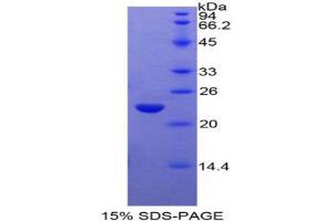 SDS-PAGE analysis of Rat GaA Protein. (GAA Protein)