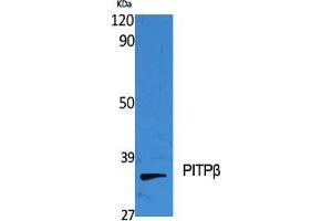 Western Blot (WB) analysis of specific cells using PITPbeta Polyclonal Antibody. (PITPNB Antikörper  (Internal Region))