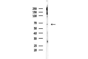 anti-RIO Kinase 1 (RIOK1) (C-Term) antibody