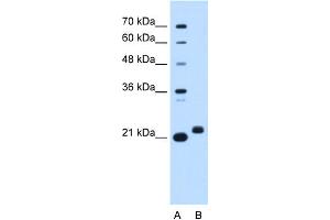 WB Suggested Anti-C1orf159 Antibody Titration:  0. (C1orf159 Antikörper  (Middle Region))