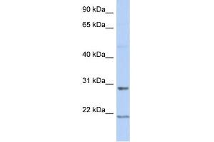 WB Suggested Anti-C12orf53 Antibody Titration: 0. (C12orf53 Antikörper  (Middle Region))