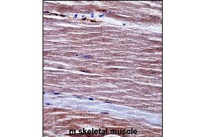 Mouse Acvr1 Antibody (Center) ((ABIN657718 and ABIN2846706))immunohistochemistry analysis in formalin fixed and paraffin embedded mouse skeletal muscle followed by peroxidase conjugation of the secondary antibody and DAB staining. (ACVR1 Antikörper  (AA 137-166))
