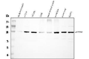 Western blot analysis of Alpha Actinin 4 using anti-Alpha Actinin 4 antibody (ABIN4886421). (alpha Actinin 4 Antikörper  (AA 561-661))