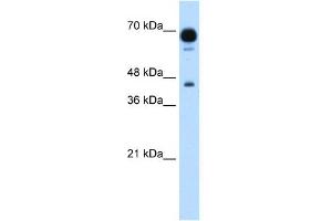 WB Suggested Anti-PUS7 Antibody Titration:  1. (PUS7 Antikörper  (N-Term))