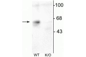 Western Blotting (WB) image for anti-gamma-aminobutyric Acid (GABA) A Receptor, alpha 6 (GABRA6) (Cytoplasmic Loop) antibody (ABIN361444)
