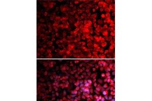 Immunofluorescence analysis of MCF7 cells using RPS10 Polyclonal Antibody