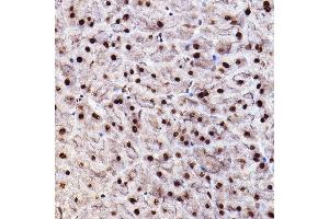 Immunohistochemistry of paraffin-embedded mouse pancreas using Phospho--S473+-S474+-S472 Rabbit pAb (ABIN7265523) at dilution of 1:100 (40x lens). (AKT 1/2/3 Antikörper  (pSer472))