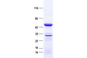 Validation with Western Blot (KCTD20 Protein (His tag))