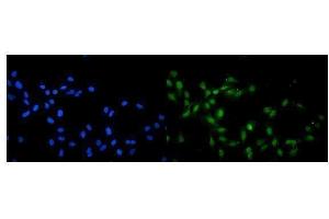IF analysis of KAT13A/SRC1 using anti-KAT13A/SRC1 antibody (ABIN3042385). (NCOA1 Antikörper  (AA 614-826))