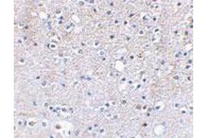 Immunohistochemical staining of human brain tissue using GRIK5 polyclonal antibody  at 2. (GRIK5 Antikörper  (C-Term))