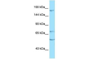 WB Suggested Anti-PTPRT Antibody Titration: 1. (PTPRT Antikörper  (C-Term))