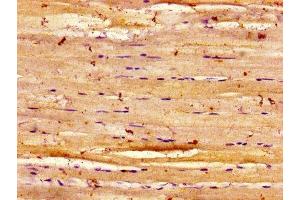 Immunohistochemistry of paraffin-embedded human skeletal muscle tissue using ABIN7150914 at dilution of 1:100 (Dysferlin Antikörper  (AA 105-278))