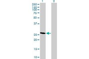 Western Blot analysis of RCAN2 expression in transfected 293T cell line by RCAN2 MaxPab polyclonal antibody. (RCAN2 Antikörper  (AA 1-225))