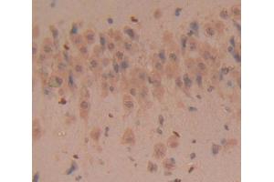 Used in DAB staining on fromalin fixed paraffin- embedded Kidney tissue (CD160 Antikörper  (AA 33-171))