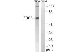 Western blot analysis of extracts from HepG2 cells, using FRS2 (Ab-196) antibody. (FRS2 Antikörper  (Tyr196))